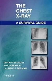 Chest X-Ray: A Survival Guide [Elektronisk resurs]; Gerald De Lacey, Simon Morley, Laurence Berman, Gerald De Lacey, Simon Morley; 2008