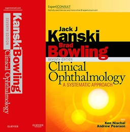 Clinical ophthalmology : a systematic approach; Jack J. Kanski; 2011