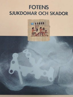 Fotens sjukdomar och skador; Jon Karlsson; 1998