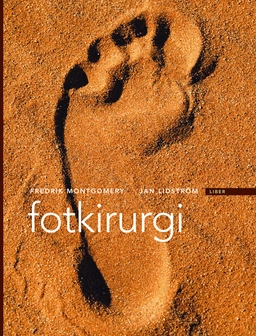 Fotkirurgi; Fredrik Montgomery; 2004
