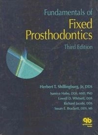 Fundamentals of fixed prosthodontics; Herbert T Shillingburg; 1997