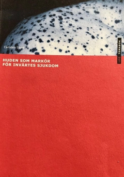 Huden som markör för invärtes sjukdom; Carsten, Sand; 2008