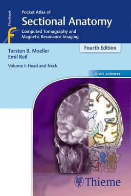Pocket atlas of sectional anatomy : computed tomography and magnetic resonance imaging. · Head and neck, Vol. 1; Torsten B. Möller, Emil Reif; 2014