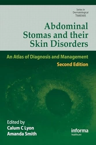 Abdominal stomas and their skin disorders : an atlas of diagnosis and management; Calum C. Lyon, Amanda J. Smith; 2010