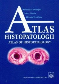 Atlas histopatologii: tajemniczy świat chorych komórek człowieka; Wenancjusz Domagała, Maria Chosia, Elżbieta Urasińska