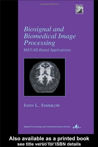 Biosignal and biomedical image processing : MATLAB-based applications; John L. Semmlow; 2004