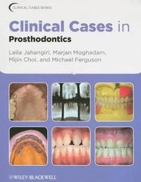 Clinical Cases in Prosthodontics; Leila Jahangiri; 2010