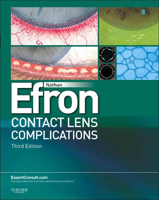Contact Lens Complications Expert Consult - Online and Print ; Nathan Efron; 2012