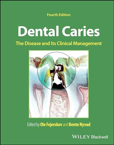 Dental Caries : the disease and its clinical management; Ole Fejerskov, Bente Nyvad; 2024