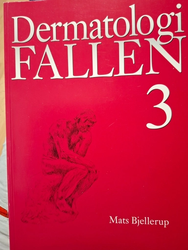 Dermatologifallen · 3