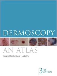 Dermoscopy