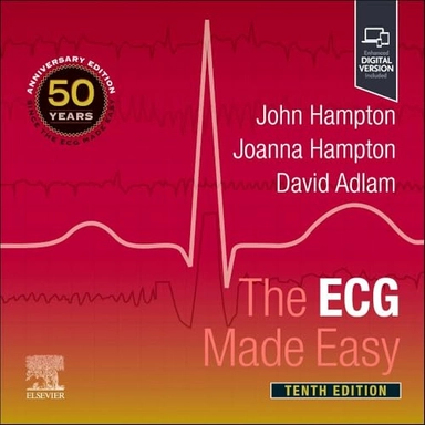 ECG Made Easy