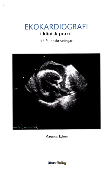 Ekokardiografi i klinisk praxis: 55 fallbeskrivningar; Magnus Edner; 2012