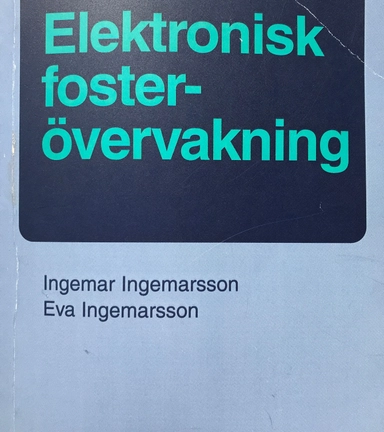 Elektronisk fosterövervakning