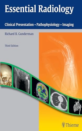 Essential Radiology : Clinical Presentation, Pathophysiology, Imaging; Richard B. Gunderman; 2014