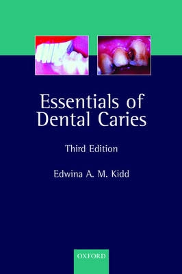 Essentials of Dental Caries: The Disease and Its Management, 3rd Ed.: The Disease and Its ManagementOxford medical publications
