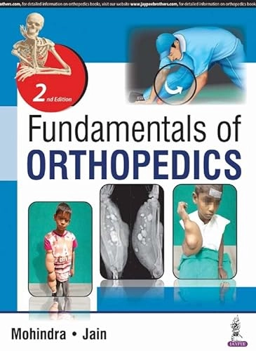 Fundamentals of Orthopedics; Mukul Mohindra, Jitesh Kumar Jain; 2017