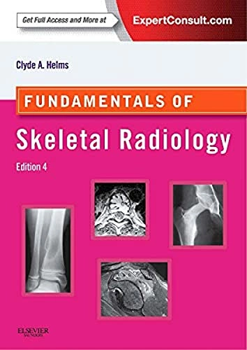 Fundamentals of skeletal radiology; Clyde A. Helms, MD; 2014