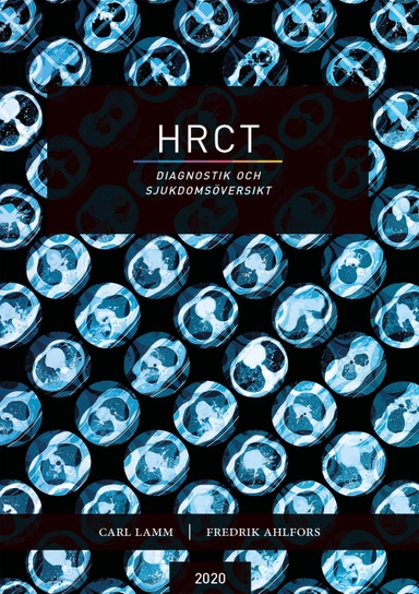 HRCT : diagnostik och sjukdomsöversikt; Carl Lamm, Fredrik Ahlfors; 2020
