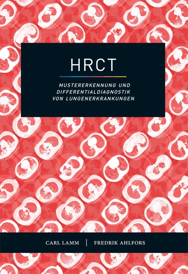 HRCT : mustererkennung und Differentialdiagnostik von Lungenerkrankungen; Carl Lamm, Fredrik Ahlfors; 2017