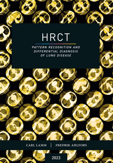 HRCT : pattern recognition and differential diagnosis of lung disease; Carl Lamm, Fredrik Ahlfors; 2023