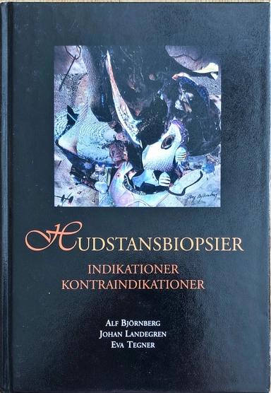 Hudstansbiopsier: indikationer, kontraindikationer