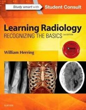 Learning radiology : recognizing the basics; William Herring; 2016