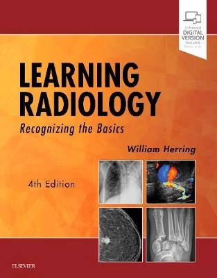 Learning radiology : recognizing the basics; William Herring; 2020