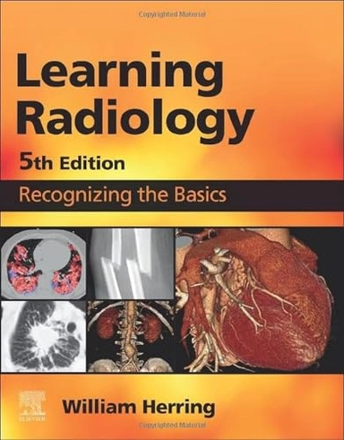 Learning radiology : recognizing the basics; William Herring; 2024