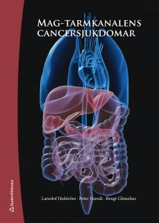Mag-tarmkanalens cancersjukdomar