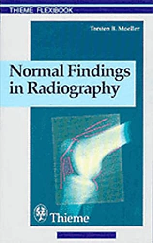 Normal findings in radiography