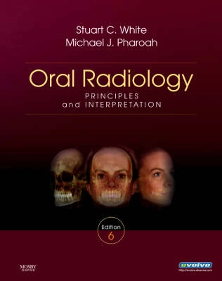 Oral radiology : principles and interpretation; Stuart C. White, Michael J. Pharoah; 2009