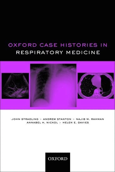 Oxford Case Histories in Respiratory Medicine; John Stradling, Andrew Stanton, Najib M Rahman, Annabel H Nickol, Helen E Davies; 2010