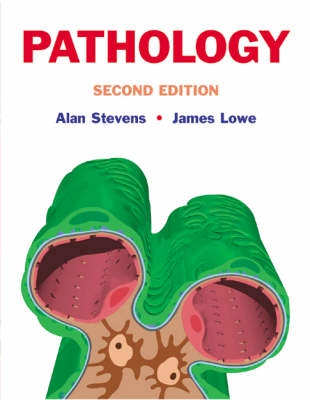 Pathology; Alan Stevens; 2000