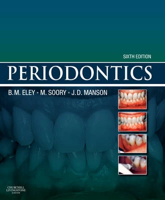 Periodontics; B. M. Eley; 2010