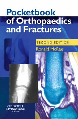 Pocketbook of orthopaedics and fractures; Ronald. McRae; 2006