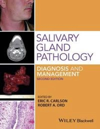 Salivary Gland Pathology Diagnosis and Management; Eric Carlson, Robert A. Ord; 2015