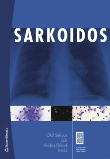 Sarkoidos