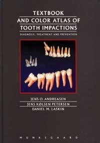 Textbook and color atlas of tooth impactions : diagnosis, treatment, prevention; J. O. Andreasen; 1997