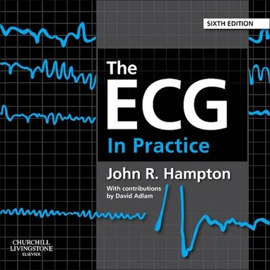 The ECG in practice