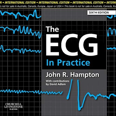 The ECG in practice