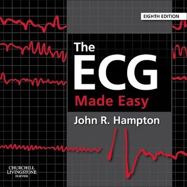 The ECG made easy