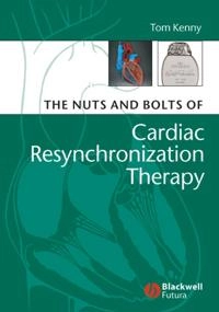 The Nuts and Bolts of Cardiac Resynchronization Therapy; Tom Kenny; 2007