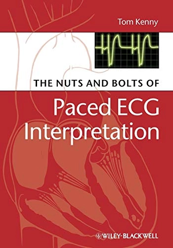 The Nuts and bolts of Paced ECG Interpretation; Tom Kenny; 2009