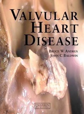 Valvular heart disease; John C. Baldwin; 2006