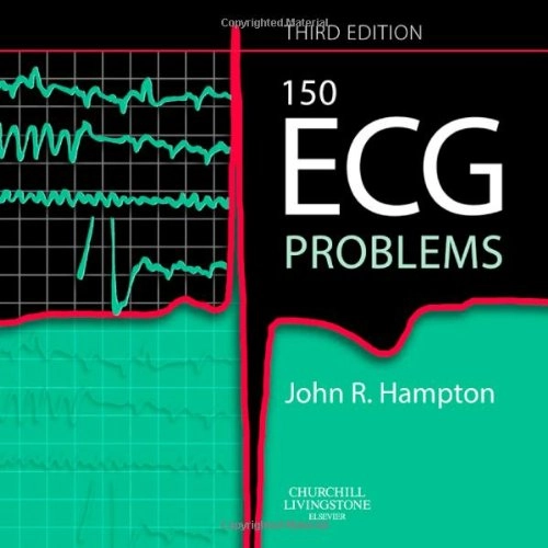 150 ECG Problems; John R Hampton; 2008