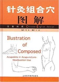 针灸组合穴图解Volym 2 av Chinese-English edition; 刘炎