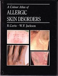 A colour atlas of allergic skin disorders; Rino Cerio; 1992