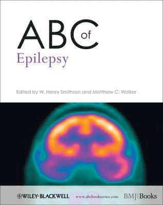 ABC of Epilepsy; W. Henry Smithson, Matthew C. Walker; 2012
