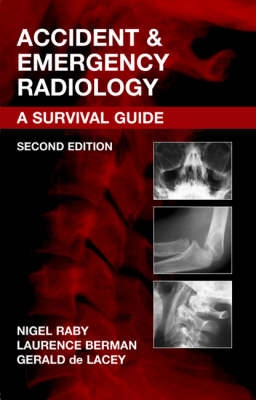 Accident & Emergency Radiology (Second Edition) [Elektronisk resurs]; Nigel Raby, Laurence Berman, Gerald De Lacey; 2005